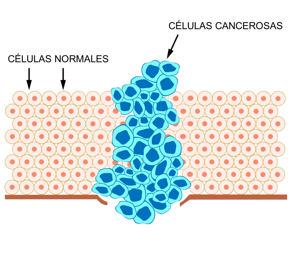 Diferencia entre células normales y células cancerígenas